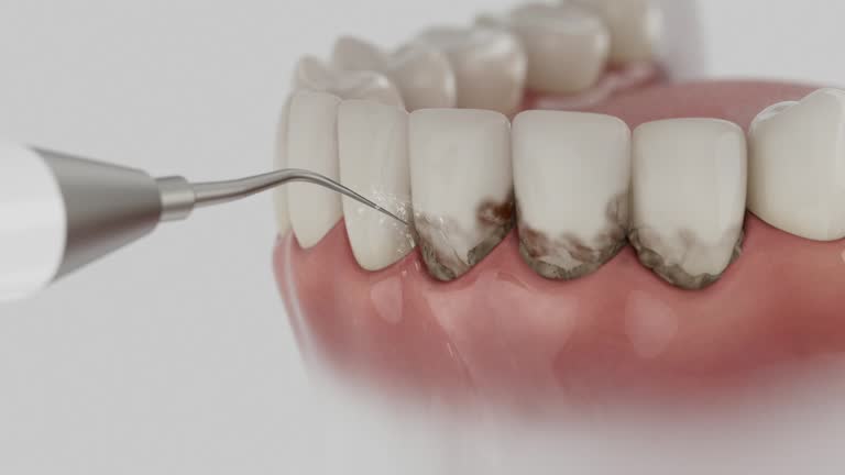 Trusted Tooth Extraction service in Columbia, MD - Dentist Open Now